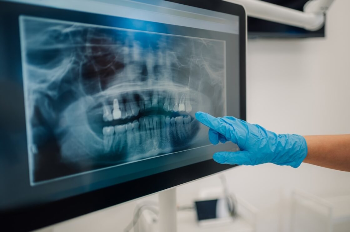 Ce este imagistica dentară?