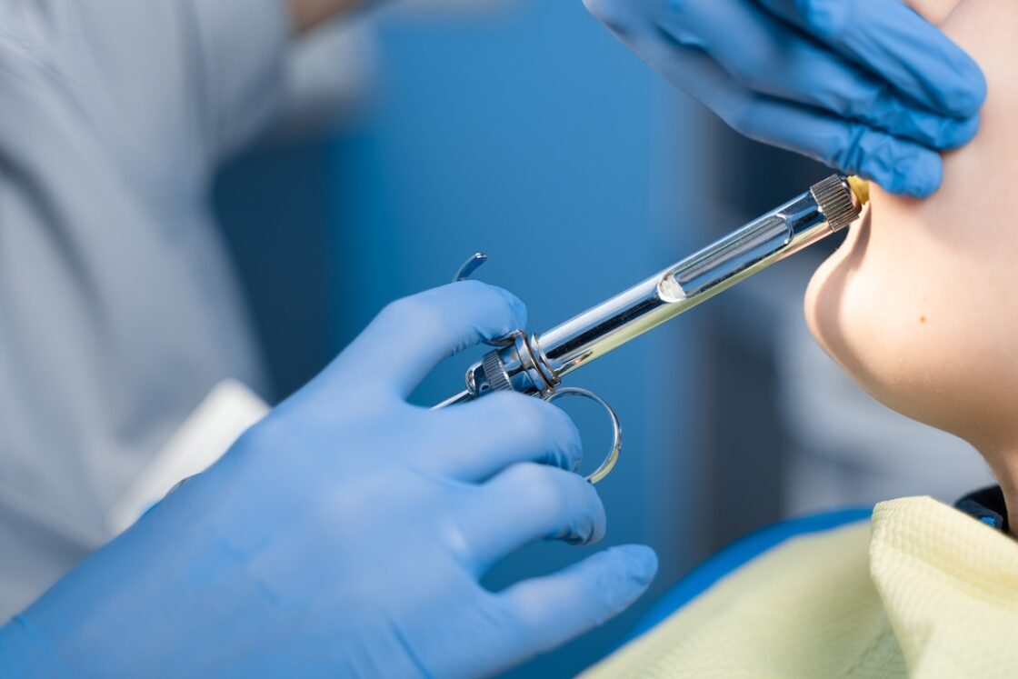Primary Tooth Extraction with Local Anesthesia
